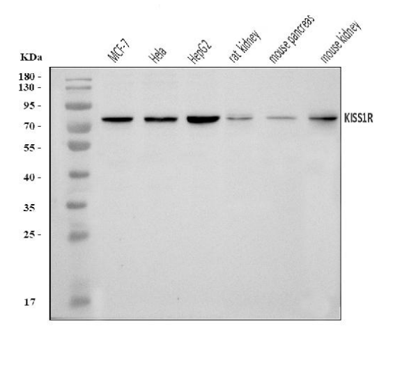 Anti-GPR54/KISS1R Antibody