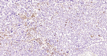 Human IL-6 Mouse Monoclonal Antibody