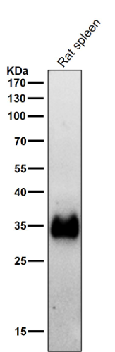 HLA-DRA/Hla Dr Rabbit Monoclonal Antibody