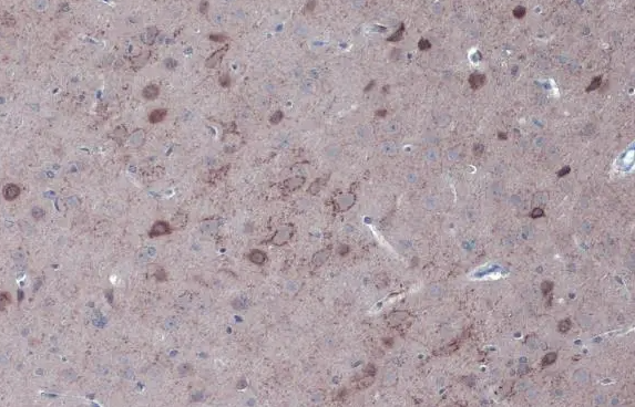 GAD67 antibody