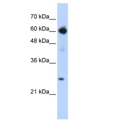 EBF1 antibody