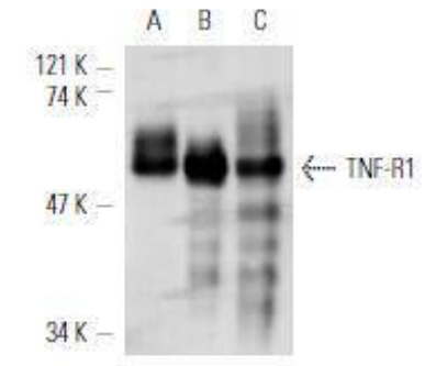 TNFR1 Antibody