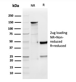 GDF9 (Growth Differentiation Factor 9) Antibody
