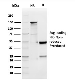 GDF9 antibody