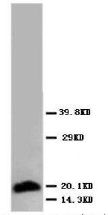 Myosin(Skeletal, Slow) Myh7 Antibody (Monoclonal, NOQ7.5.4D)