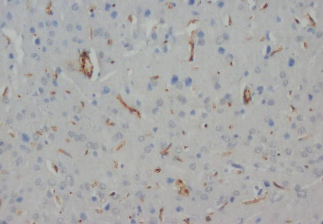 Anti-NEFH Antibody (Monoclonal, N52)