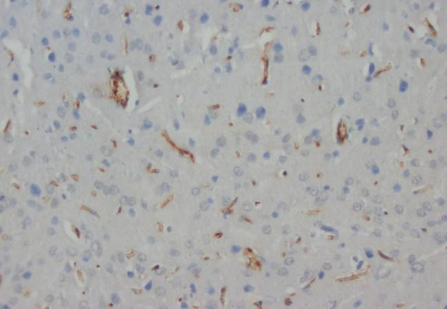 NEFH Antibody (Monoclonal, N52)