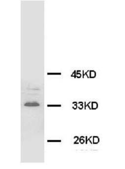 Synaptophysin Syp Antibody (Monoclonal, SVP-38)