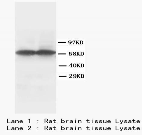 Tyrosine Hydroxylase Antibody (Monoclonal, TH-16)