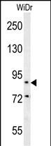 SLC39A10 antibody