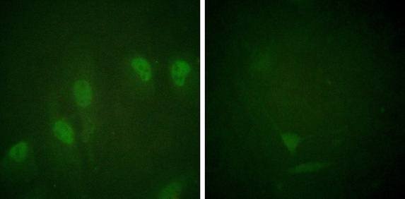 Myc (Phospho-Ser62) Antibody
