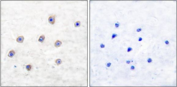 Tyrosine Hydroxylase (Phospho-Ser31) antibody