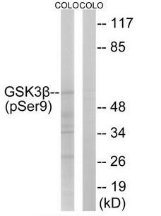 GSK3 beta (Phospho-Ser9) antibody
