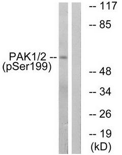 PAK1 (Phospho-Ser199) antibody