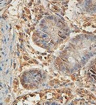 A1CF Rabbit Polyclonal Antibody