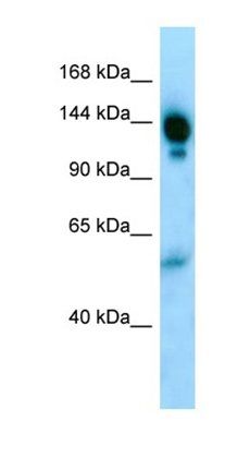 A2M antibody