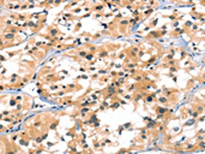 A4GALT Antibody