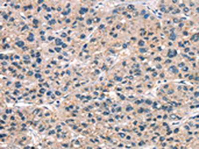 A4GALT Antibody