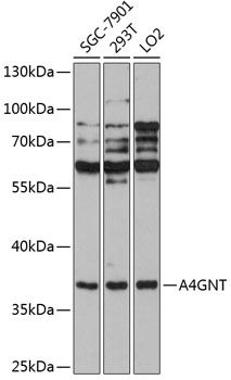 A4GNT antibody