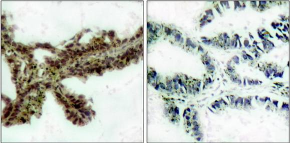 Akt (Phospho-Thr308) Antibody