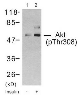 Akt (Phospho-Thr308) Antibody