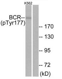 Bcr (Phospho-Tyr177) antibody