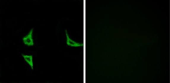 CaMK2 (Phospho-Thr286) antibody