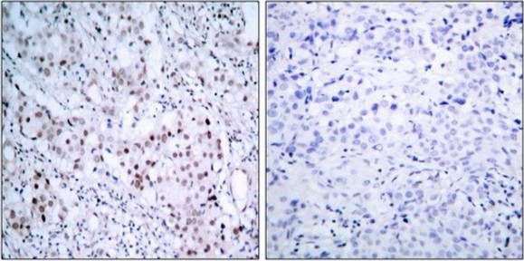 c-Jun (Phospho-Ser63) antibody