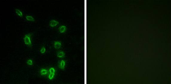 DARPP-32 (Phospho-Thr34) antibody