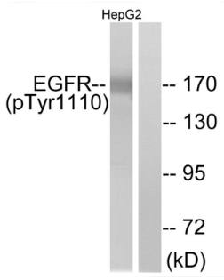 EGFR (Phospho-Tyr1110) antibody