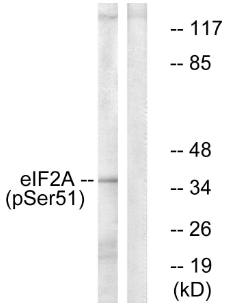 eIF2 alpha (Phospho-Ser51) antibody