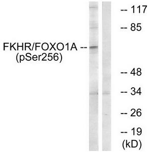 FKHR (Phospho-Ser256) antibody