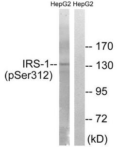 IRS-1 (Phospho-Ser312) antibody