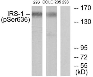 IRS-1 (Phospho-Ser636) antibody