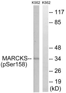 MARCKS (Phospho-Ser158) antibody