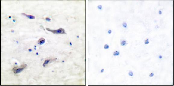 mTOR (Phospho-Ser2448) antibody