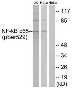 NFkB p65 (Phospho-Ser529) antibody