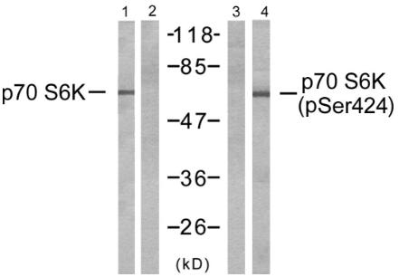 p70 S6 Kinase (Phospho-Ser424) antibody