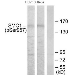SMC1 (Phospho-Ser957) antibody
