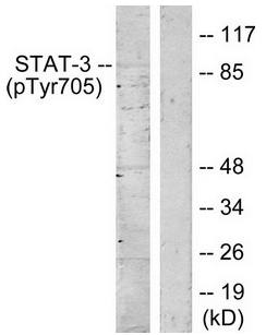 STAT3 (Phospho-Tyr705) antibody