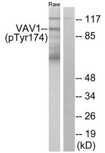 VAV1 (Phospho-Tyr174) antibody