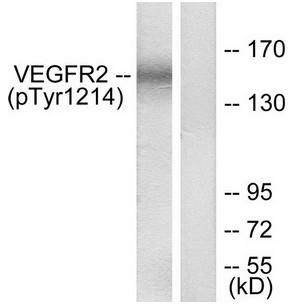 VEGFR2 (Phospho-Tyr1214) antibody