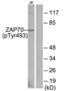 ZAP-70 (Phospho-Tyr493) antibody