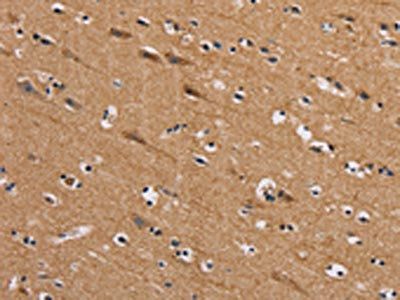 AAAS Antibody