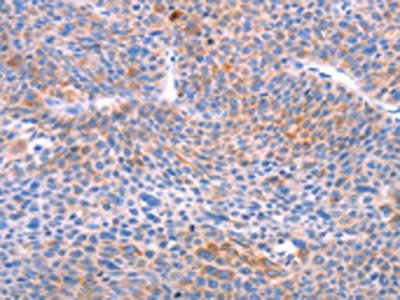 AADAC Antibody