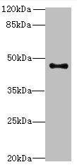 AADACL2 antibody