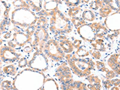 AADACL2 antibody