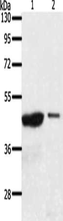 AADACL4 antibody