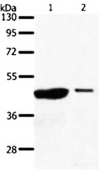 AADACL4 Antibody