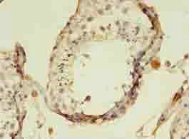 AADAT Antibody